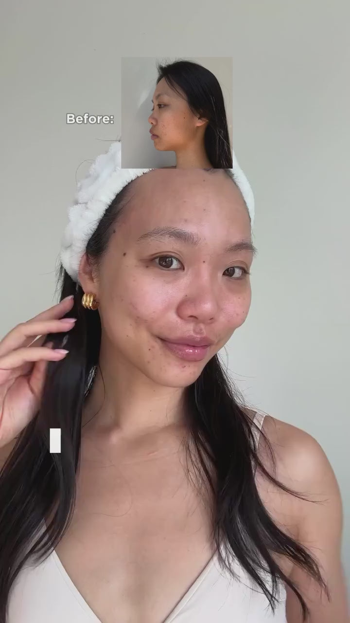 IPL Wrinkle-Reducing Device
